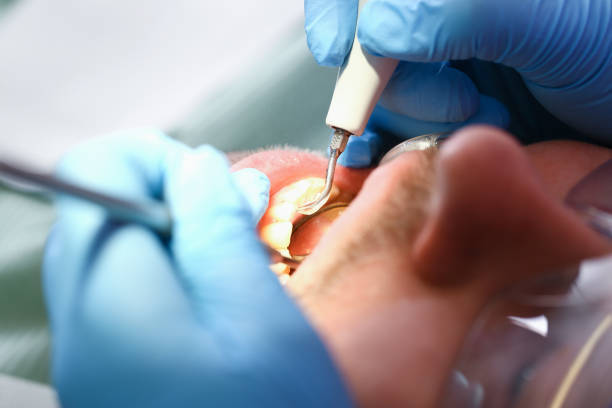 Best Broken Tooth Emergency  in Lewisburg, PA