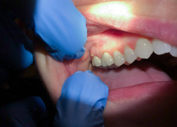 Best Emergency Gum Pain Relief  in Lewisburg, PA